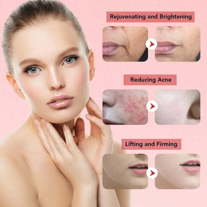 Face Lift Skin Rejuvenation Facial Massager Face Lift Skin Rejuvenation Facial Massager - Lacatang Shop  Lacatang Shop Lacatang Shop 